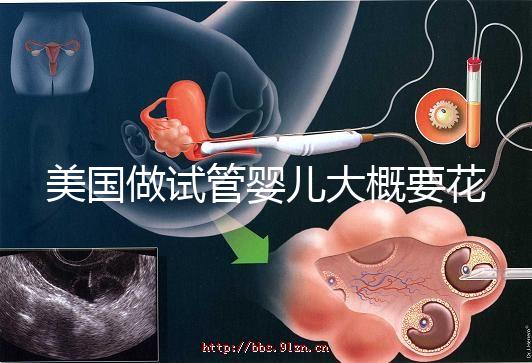 美國做試管嬰兒大概要花多少錢?具體支出25w!
