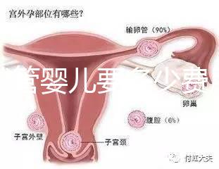 做試管嬰兒要多少費用（做試管嬰兒要多少費用？）