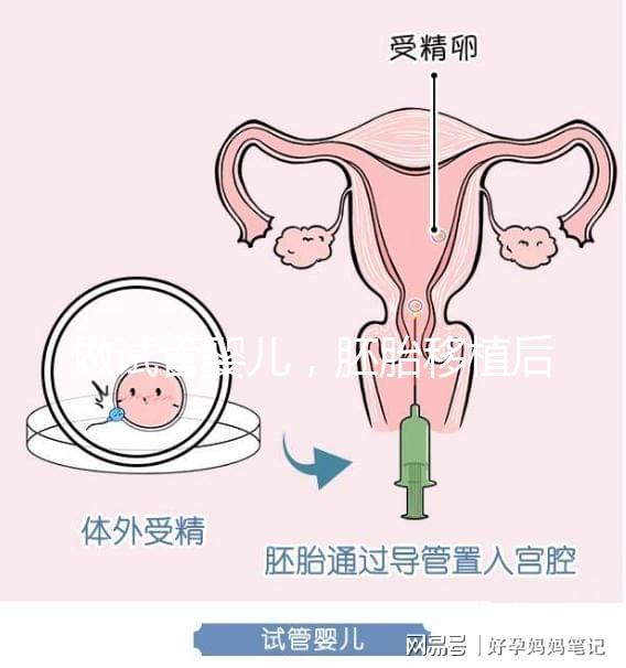 做試管嬰兒，胚胎移植后需要住院嗎？