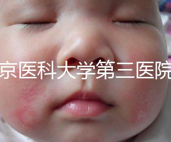 北京醫(yī)科大學(xué)第三醫(yī)院nt檢查費(fèi)用盤點(diǎn)需要多長時(shí)間,是否預(yù)約