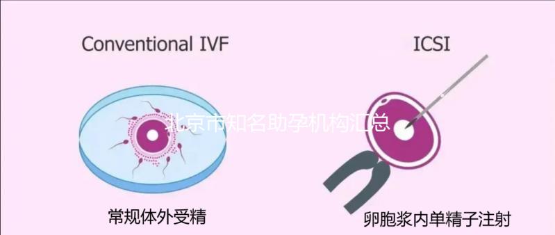 北京市知名助孕機構(gòu)匯總，成功率多少一看便知！