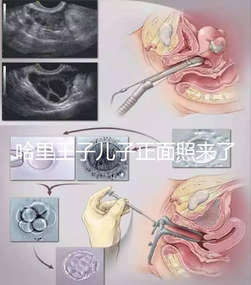 哈里王子兒子正面照來了，梅根評價：氣質甜美，乖巧