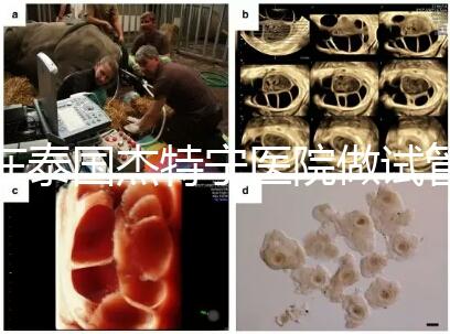 在泰國杰特寧醫(yī)院做試管嬰兒的費用明細和醫(yī)院排名清單,輕松規(guī)劃你的試管旅程!