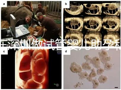 在深圳做試管嬰兒助孕私人機構(gòu)收費標準是怎樣的