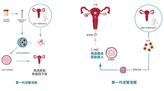 了解二代試管嬰兒:技術(shù)原理與優(yōu)勢解析