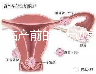 二胎臨產前的7大跡象，出現見紅、陣痛別大意