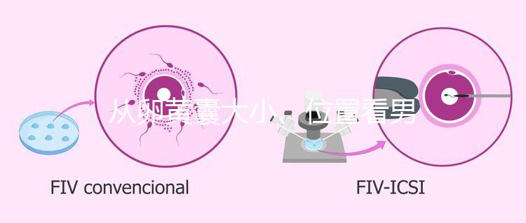 從卵黃囊大小、位置看男女，寶寶性別分辨一眼就準