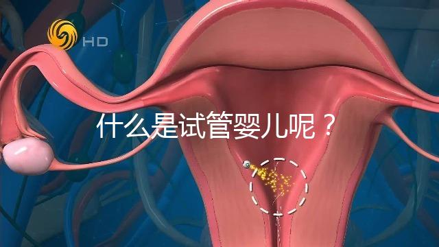 什么是試管嬰兒呢？