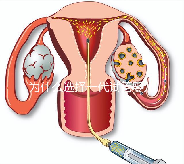 為什么選擇一代試管嬰兒?全面解析其獨特優勢與適用場景