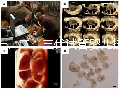 一、二、三代試管嬰兒技術的區(qū)別，看完你就知道了！