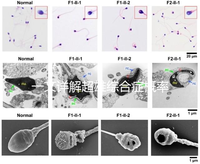 一文詳解超雄綜合癥概率有多大，想造的人多不多看過來