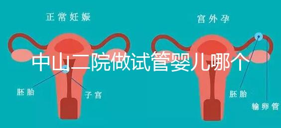 中山二院做試管嬰兒哪個醫生好？附醫院試管成功率