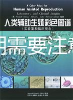 懷孕初期需要注意事項有哪些