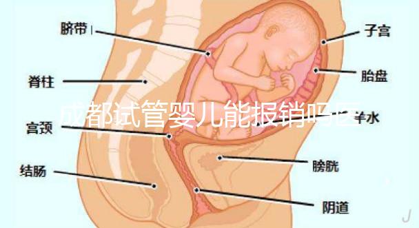 成都試管嬰兒能報銷嗎醫保？政策解讀