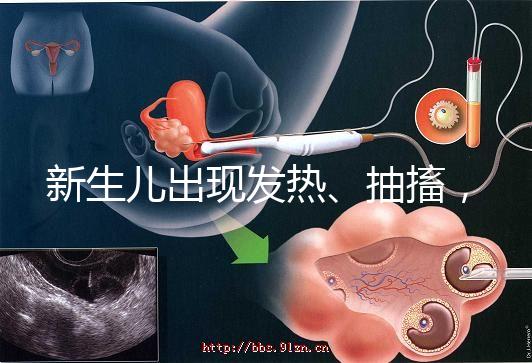 新生兒出現發熱、抽搐，很可能是胎毒的表現