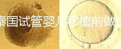泰國(guó)試管嬰兒移植前做這3件事能提高成功率,不然會(huì)后悔!