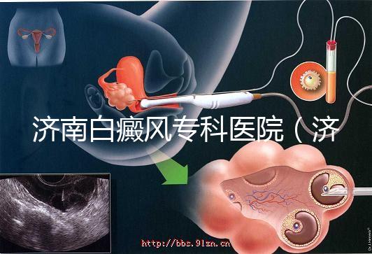 濟(jì)南白癜風(fēng)專(zhuān)科醫(yī)院(濟(jì)南白點(diǎn)癲風(fēng)醫(yī)院排名)