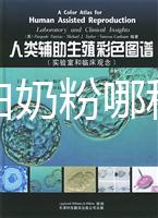水解蛋白奶粉哪種好？口感和消化分析這個品牌出彩