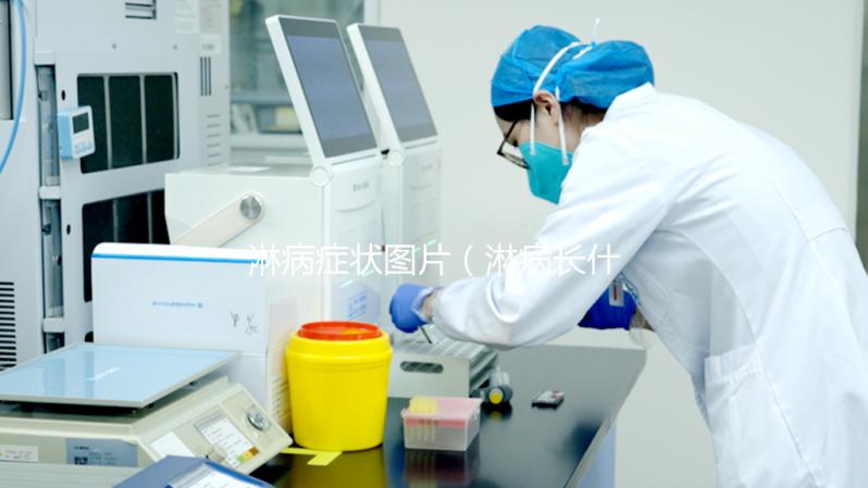 淋病癥狀圖片（淋病長(zhǎng)什么樣子圖片）