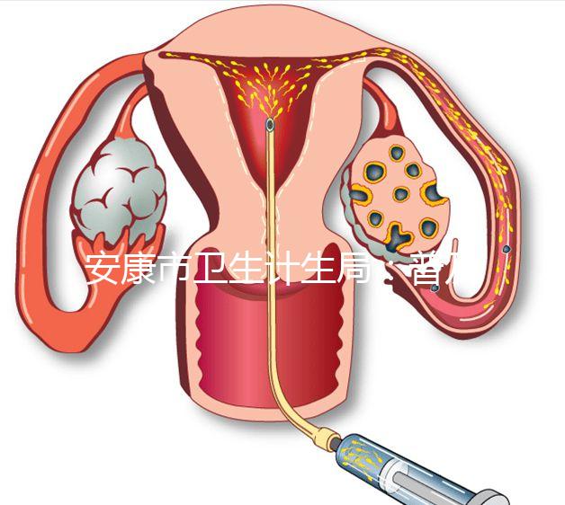 安康市衛(wèi)生計(jì)生局:普及優(yōu)生優(yōu)育五項(xiàng)檢查相關(guān)知識(shí)