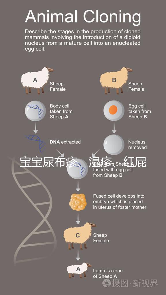 寶寶尿布疹、濕疹、紅屁股傻傻分不清？4點區別輕松診斷