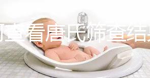 如何查看唐氏篩查結果,珠海醫(yī)院價格二百四起