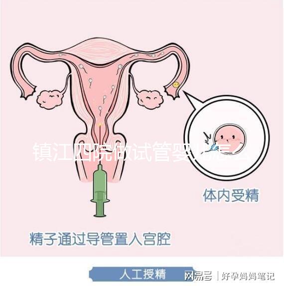 鎮(zhèn)江四院做試管嬰兒怎么樣？具體成功率費(fèi)用介紹