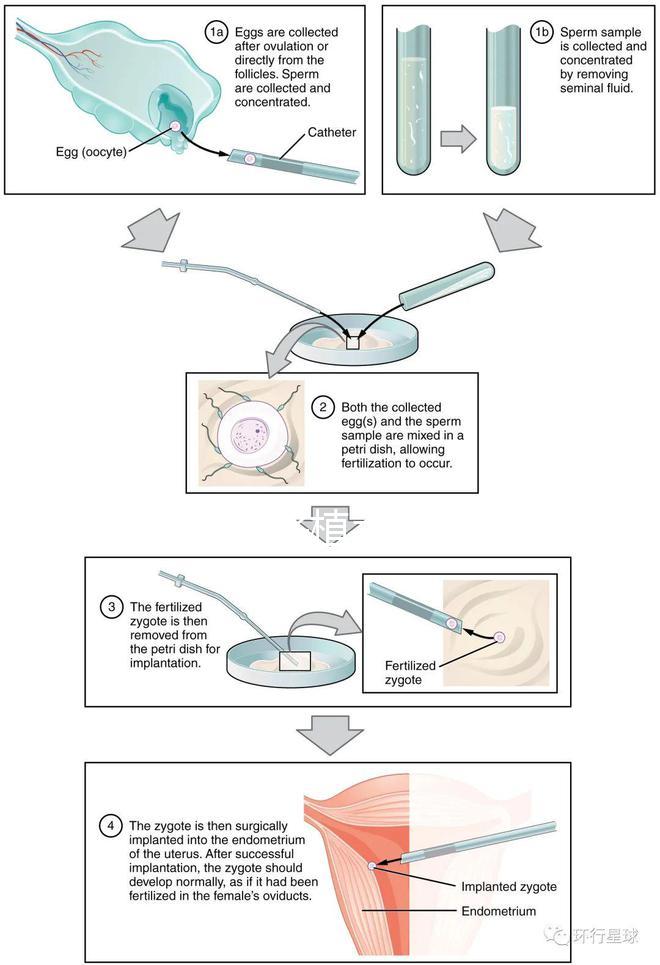 試管嬰兒移植手術(shù)（試管嬰兒移植手術(shù)需要多長時間）