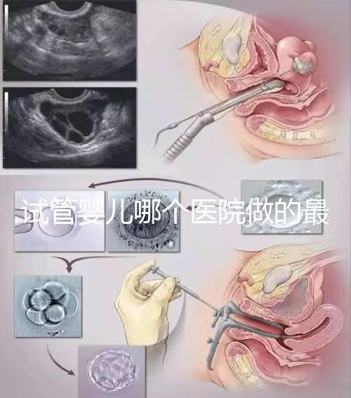 試管嬰兒哪個醫(yī)院做的最好呢?多家權(quán)威機(jī)構(gòu)推薦