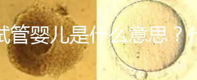 試管嬰兒是什么意思？什么是試管嬰兒？