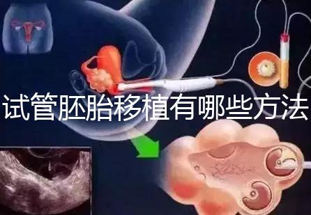 試管胚胎移植有哪些方法？