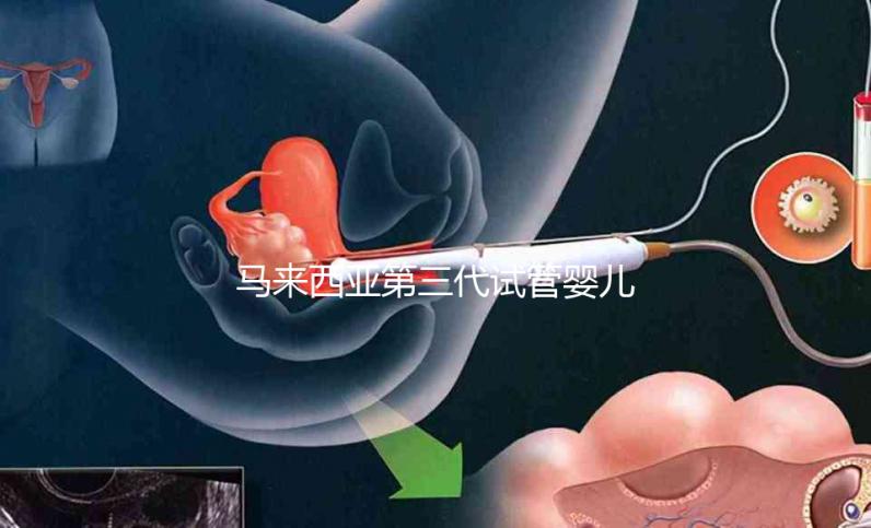 馬來西亞第三代試管嬰兒生子攻略,附詳細流程與注意事項!