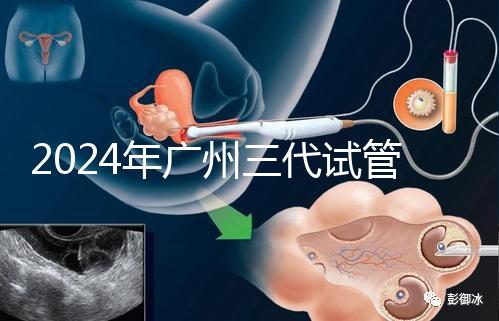 2024年廣州三代試管嬰兒費用明細公布！