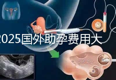 2025國(guó)外助孕費(fèi)用大公開(kāi):?jiǎn)紊砣耸抠M(fèi)用對(duì)比與機(jī)構(gòu)推薦