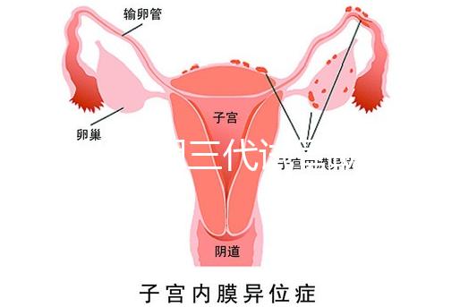 2025昆明三代試管助孕機構收費明細，價格8萬至15萬不等